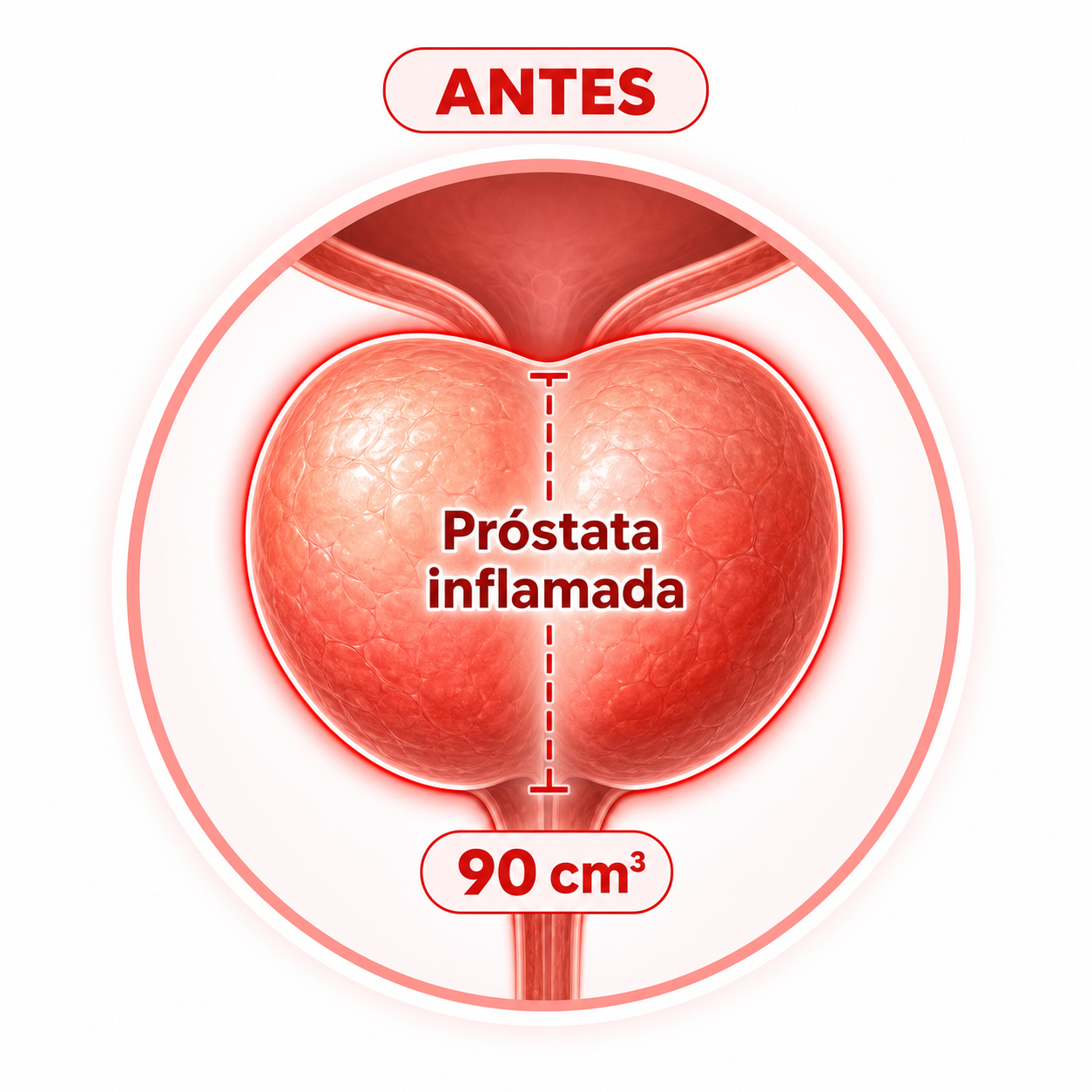 Antes