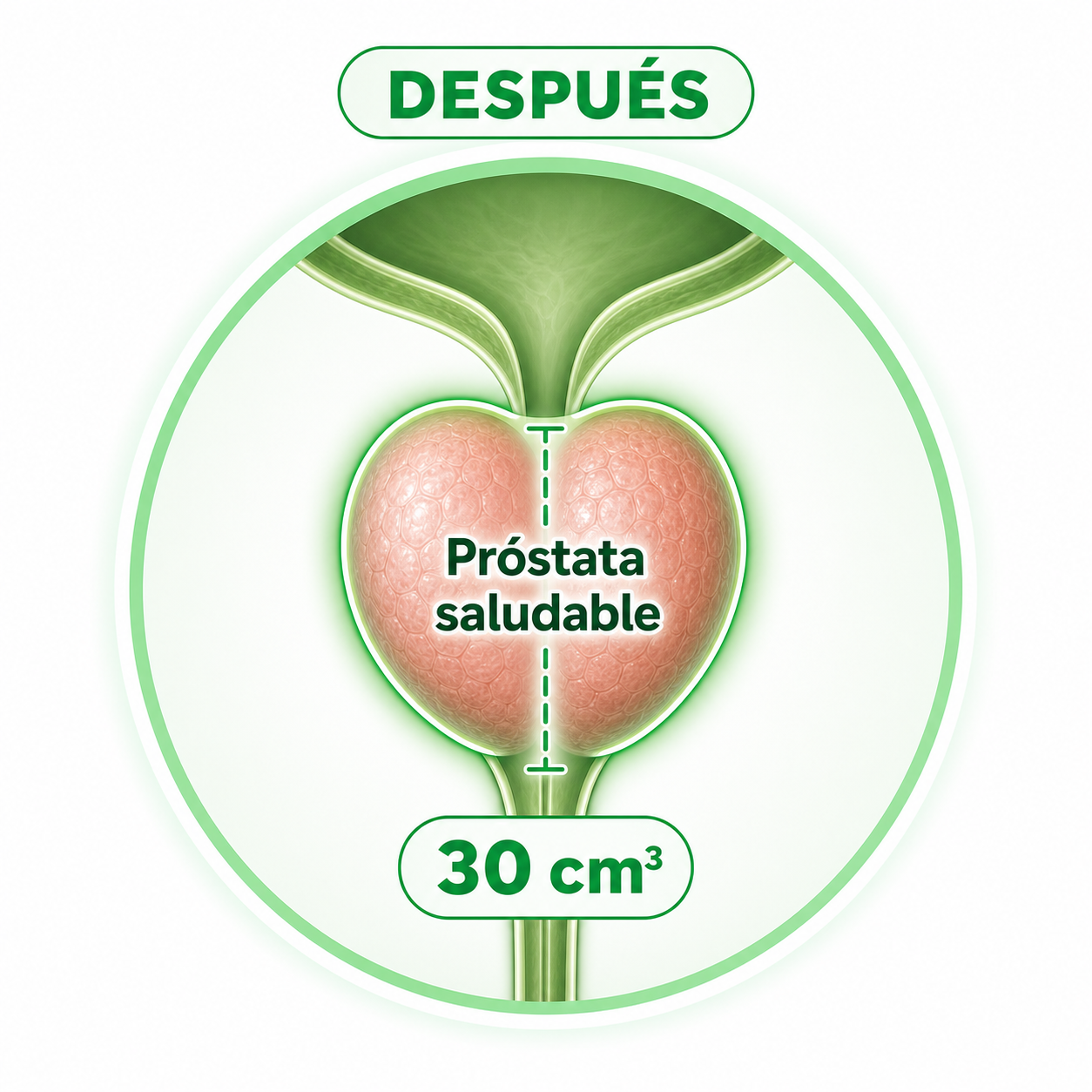 Después